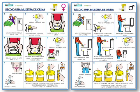 Recogida de muestra de orina.