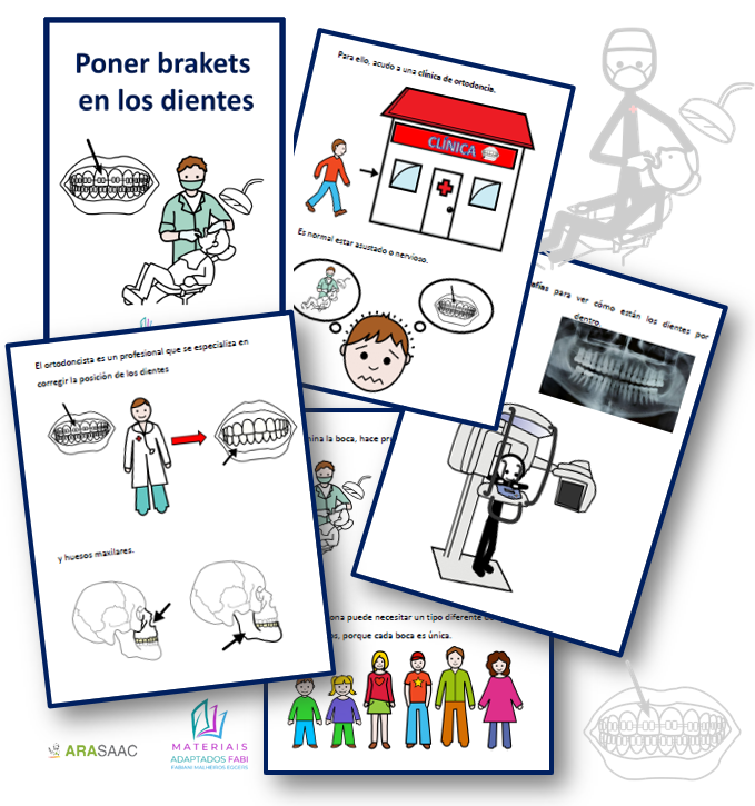 Historia social: Poner brackets 